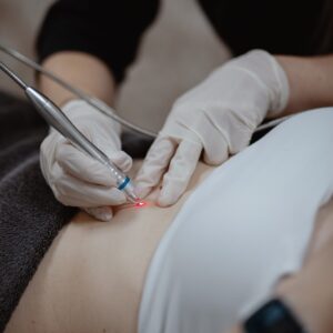 Goedaardige huidoneffenheden